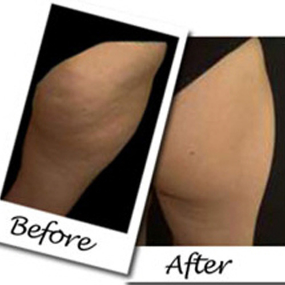 Buttock Enhancing Crepe Erasing erase Crepe skin toner cream - Picture 2 of 4